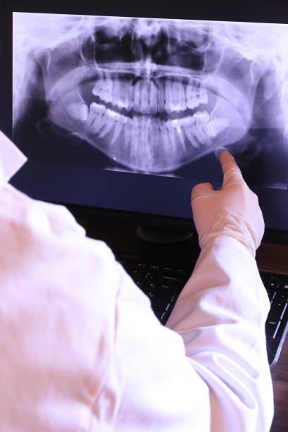 Best Chipped Tooth Repair Near Me  in Gainesville, FL